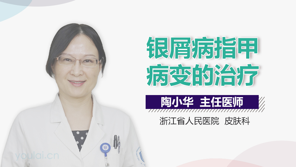 银屑病指甲病变的治疗