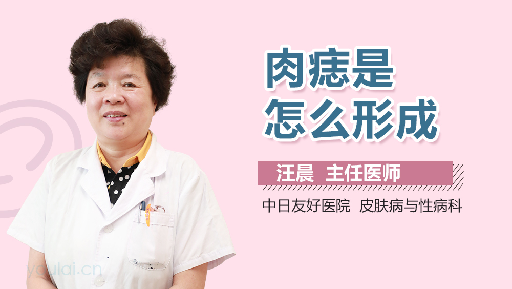 肉痣是怎么形成的