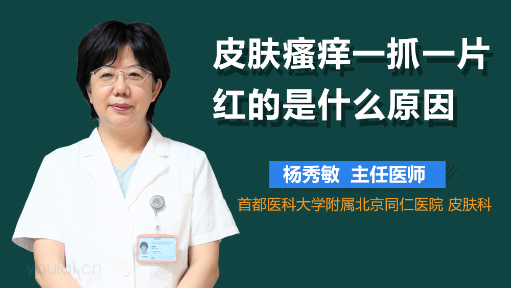 皮肤瘙痒一抓一片红的是什么原因