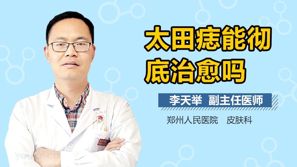 太田痣能彻底治愈吗