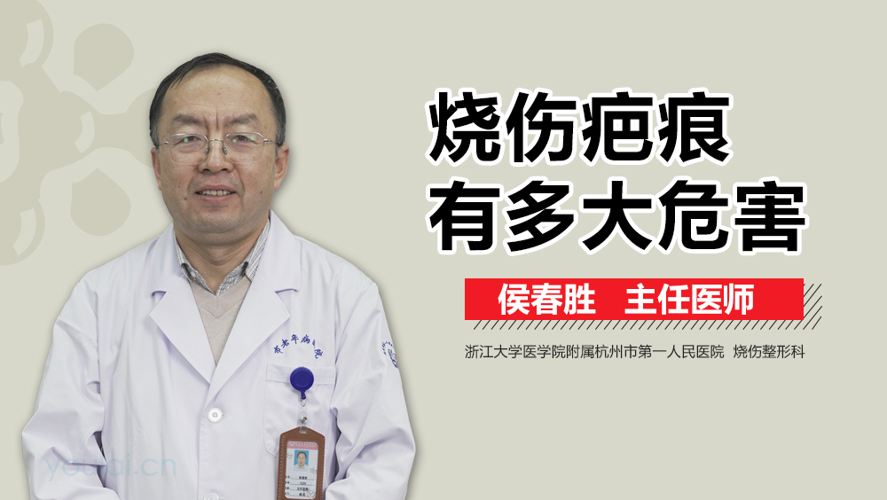 烧伤疤痕有多大危害