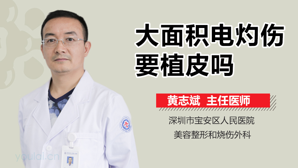 大面积电灼伤要植皮吗