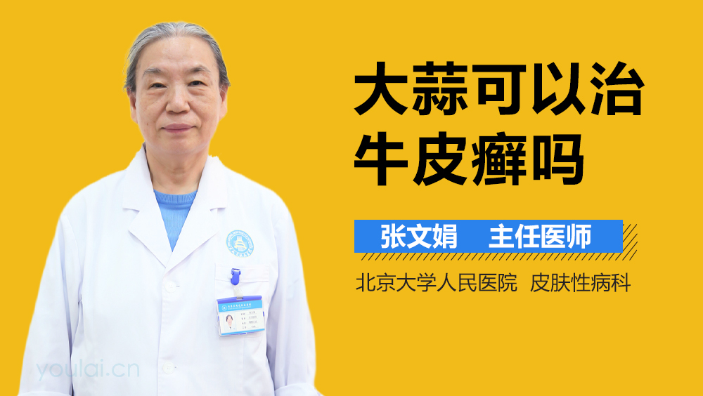 大蒜可以治牛皮癣吗