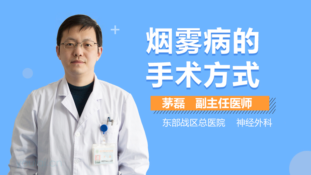 烟雾病的手术方式