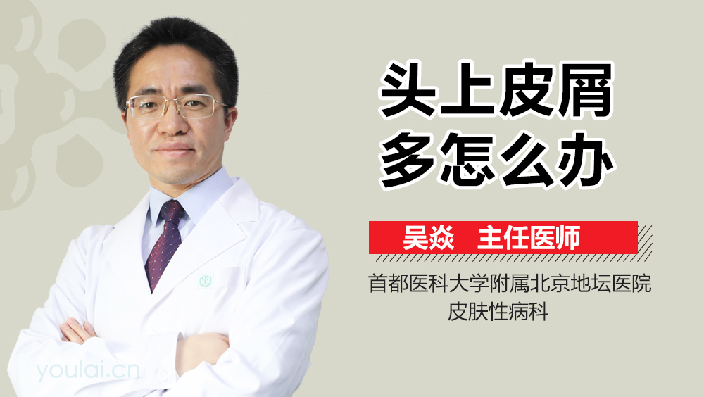 头上皮屑多怎么办