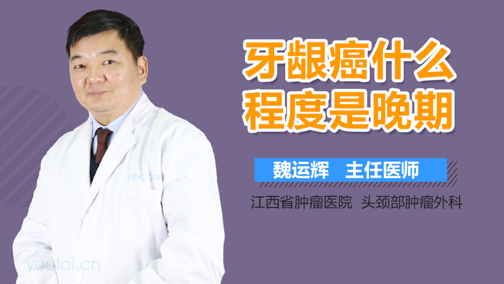 牙龈癌什么程度是晚期