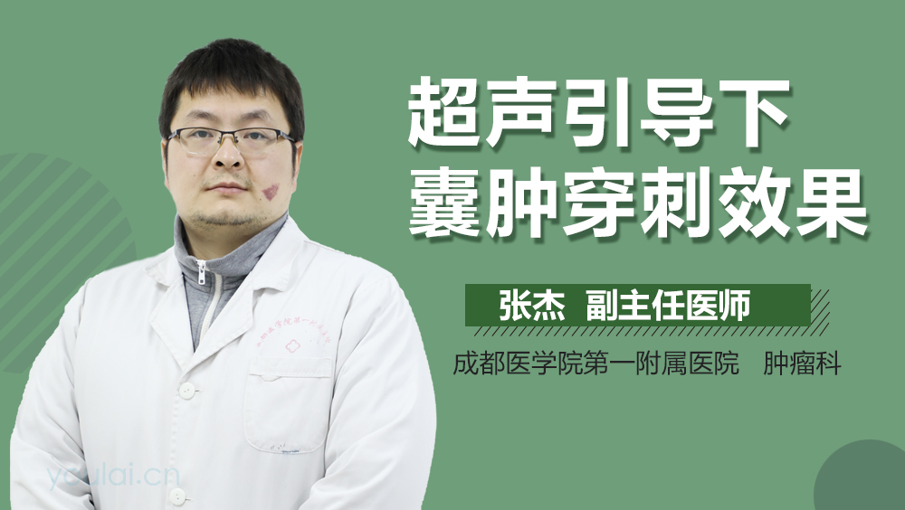 超声引导下囊肿穿刺效果