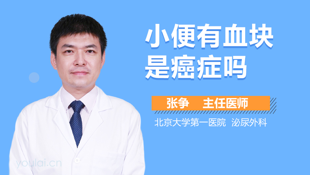 小便有血块是癌症吗