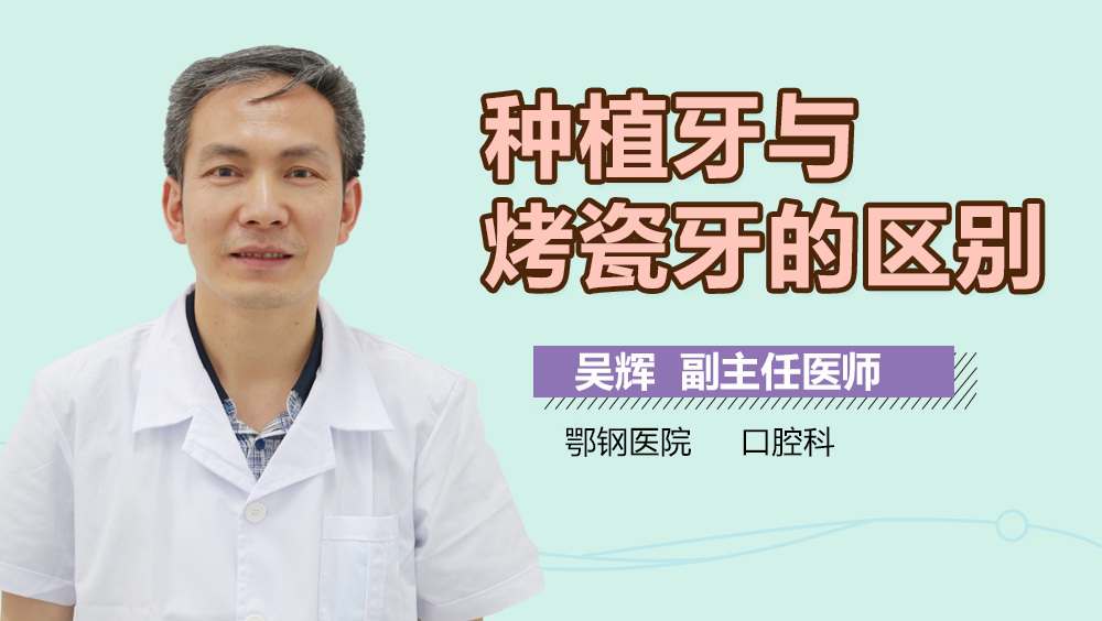 种植牙与烤瓷牙的区别