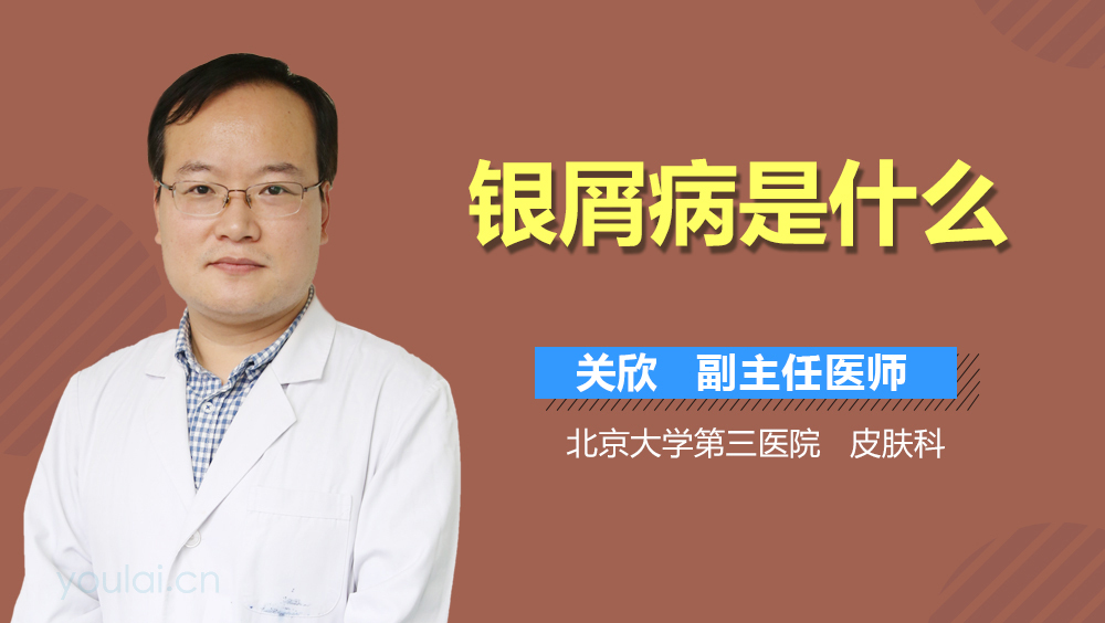 银屑病是什么