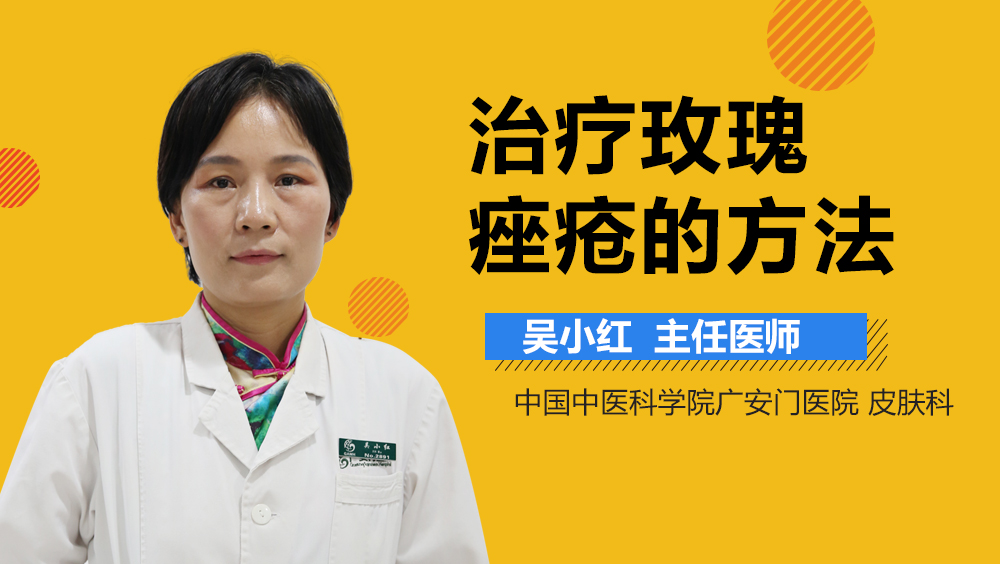 治疗玫瑰痤疮的方法