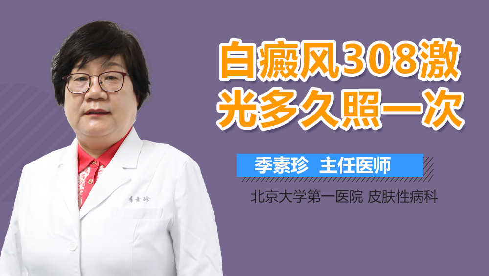 白癜风308激光多久照一次