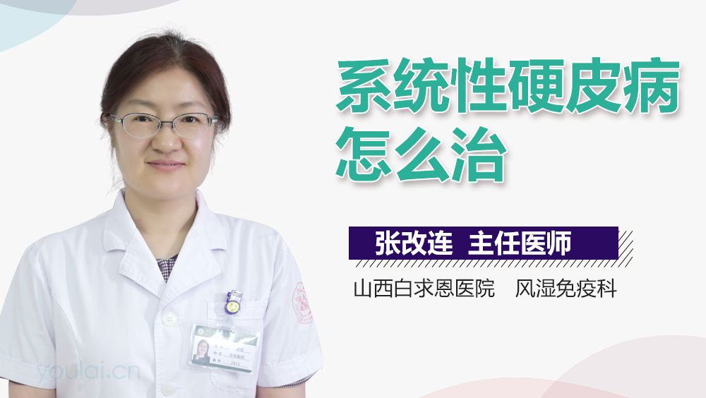 系统性硬皮病怎么治