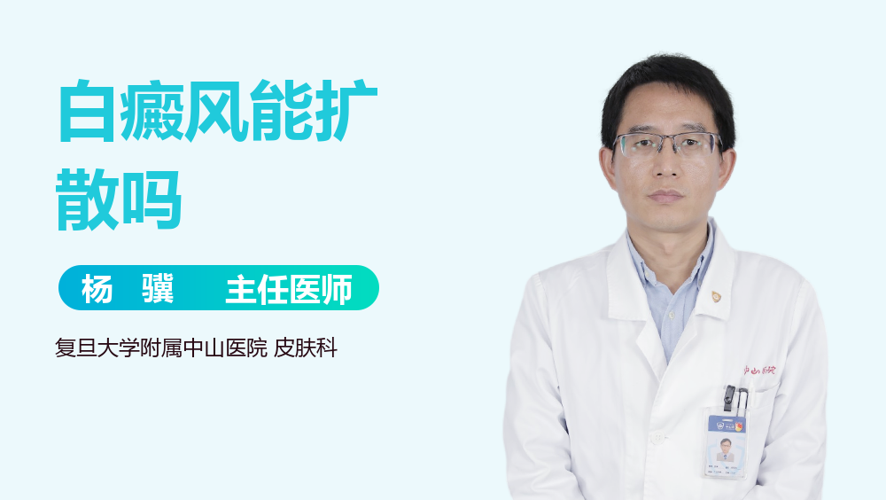 白癜风能扩散吗