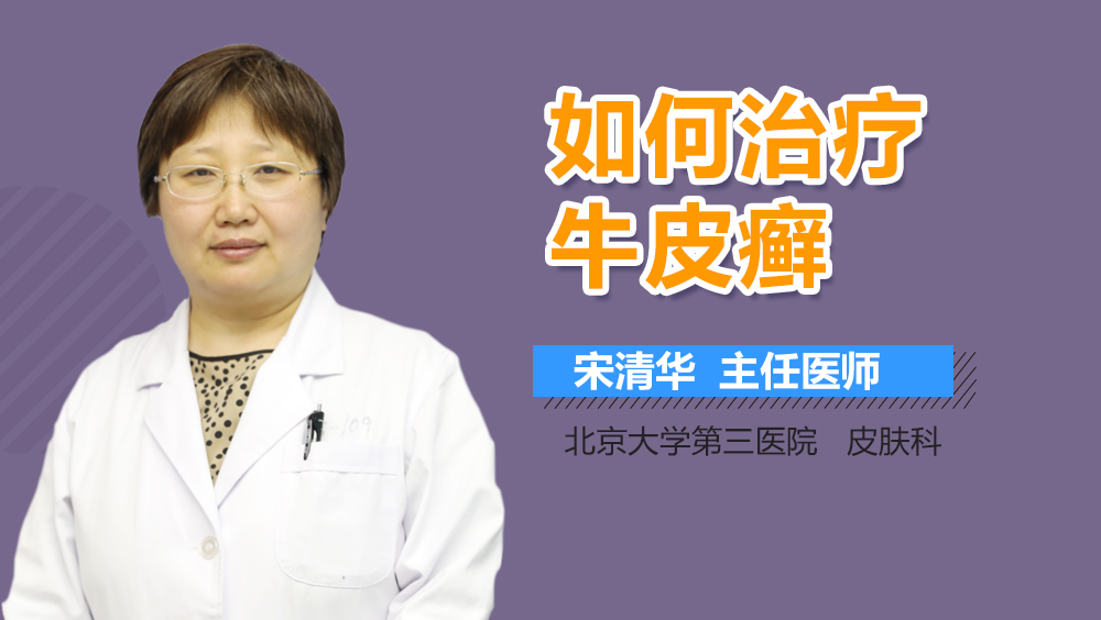 如何治疗牛皮癣