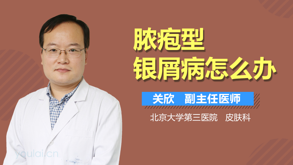 脓疱型银屑病怎么办