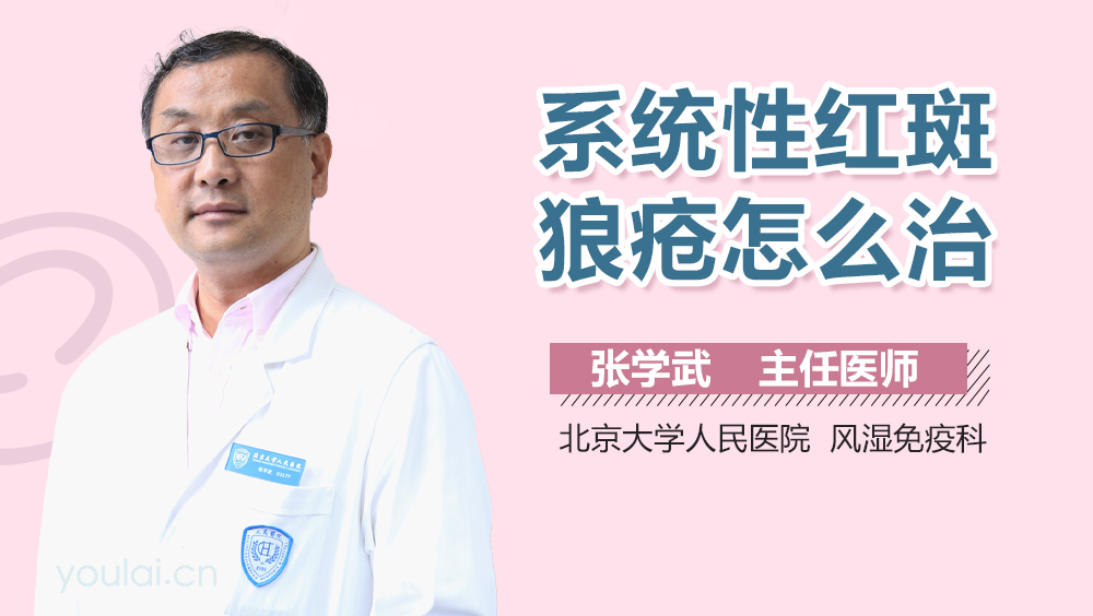 系统性红斑狼疮怎么治