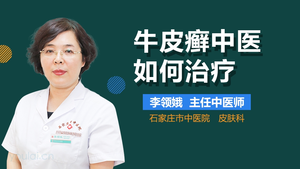牛皮癣中医如何治疗