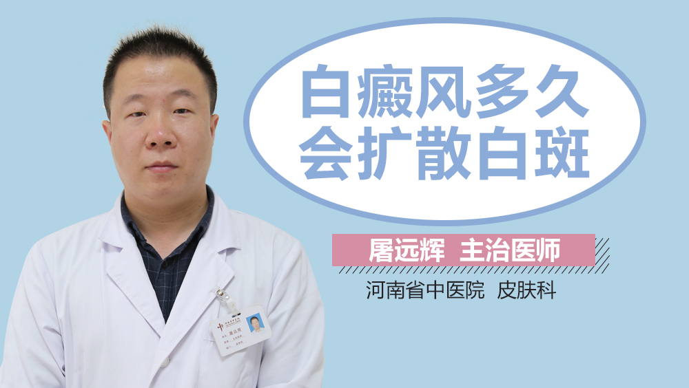 白癜风多久会扩散白斑