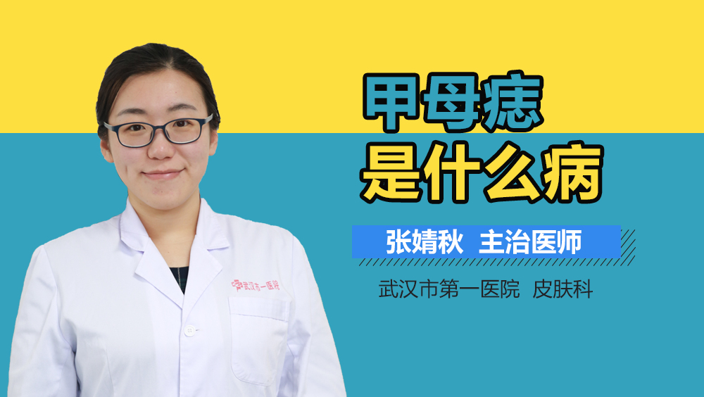 甲母痣是什么病