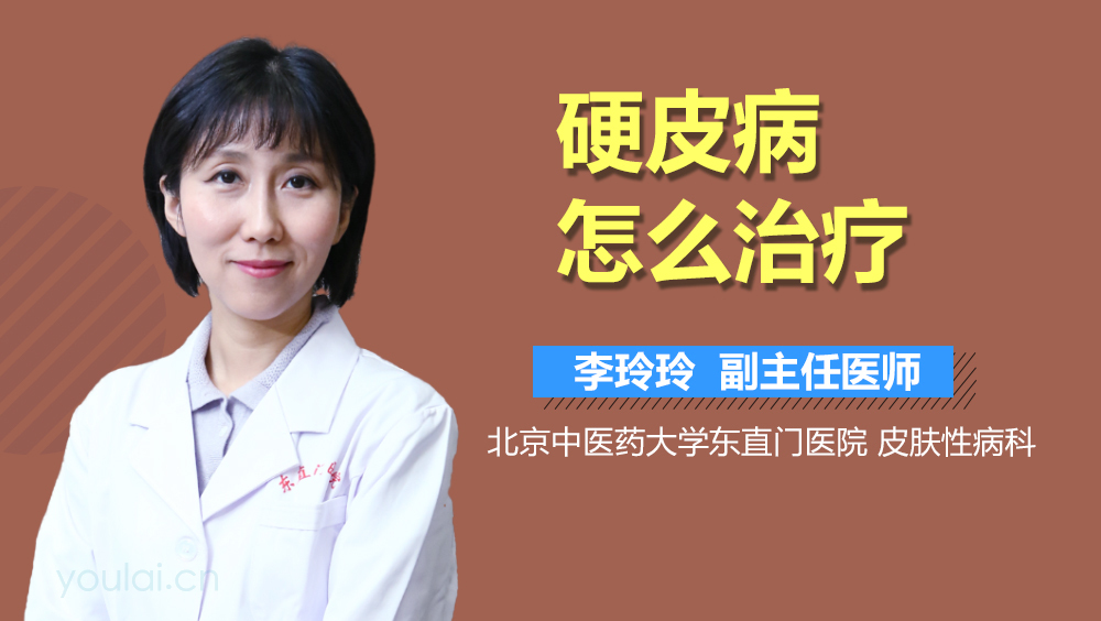 硬皮病怎么治疗