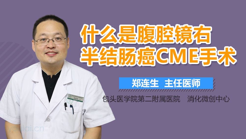 什么是腹腔镜右半结肠癌CME手术