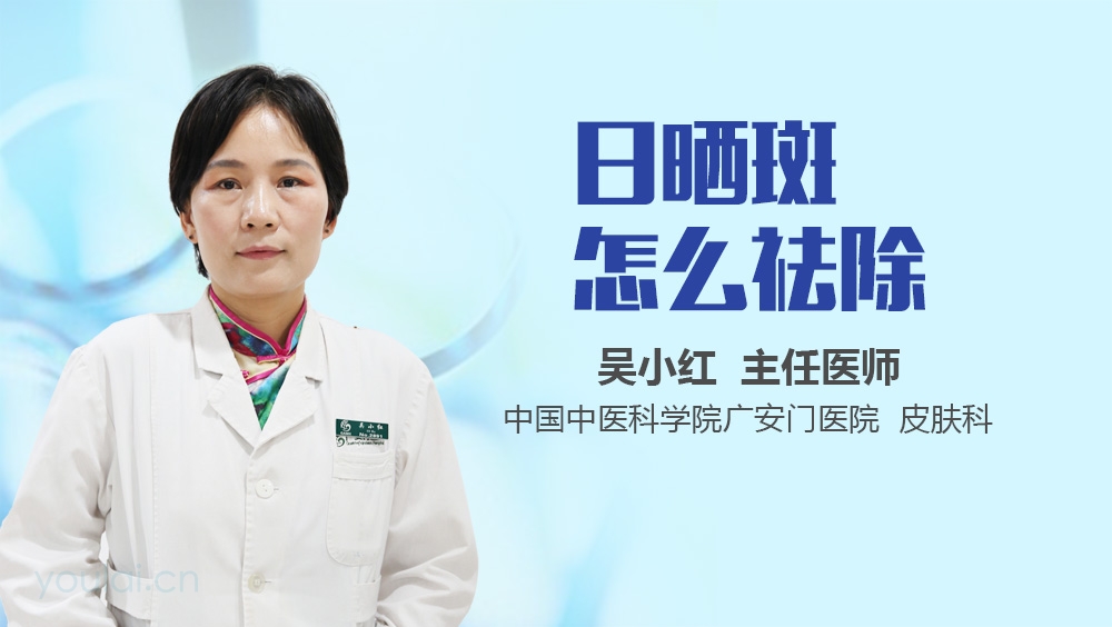 日晒斑怎么祛除