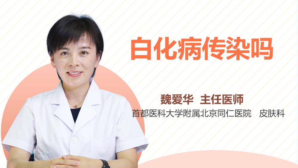 白化病传染吗