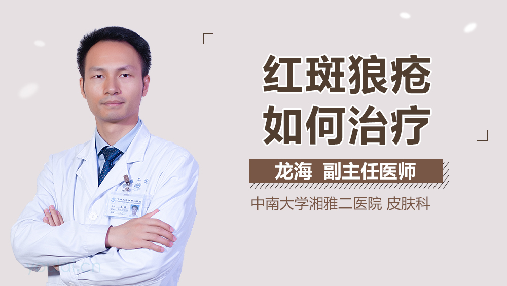 红斑狼疮如何治疗