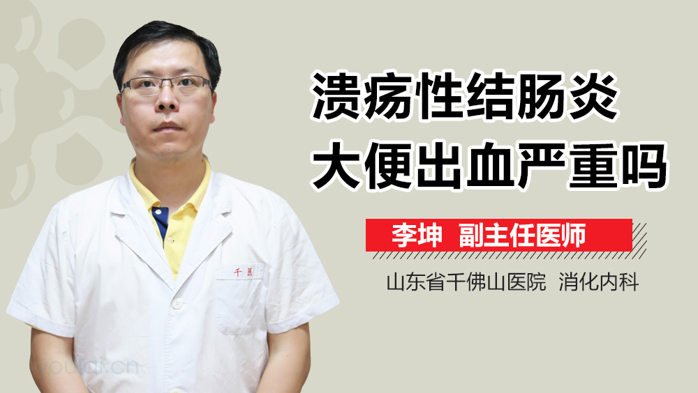 溃疡性结肠炎大便出血严重吗