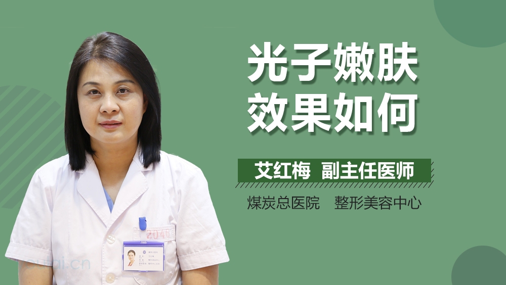 光子嫩肤效果如何
