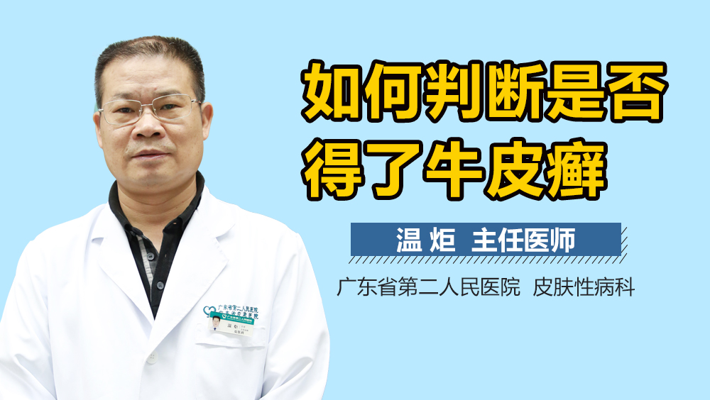 如何判断是否得了牛皮癣