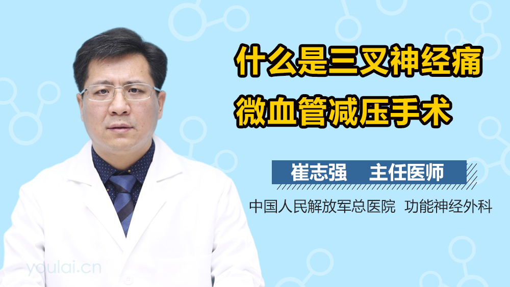 什么是三叉神经痛微血管减压手术