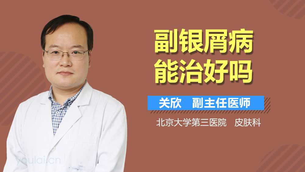 副银屑病能治好吗