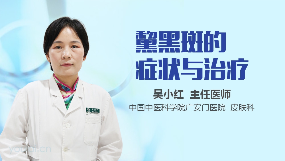 黧黑斑的症状与治疗