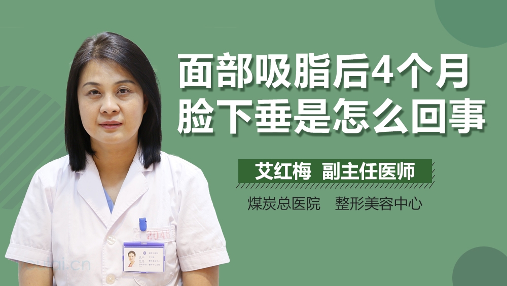 面部吸脂后4个月脸下垂是怎么回事
