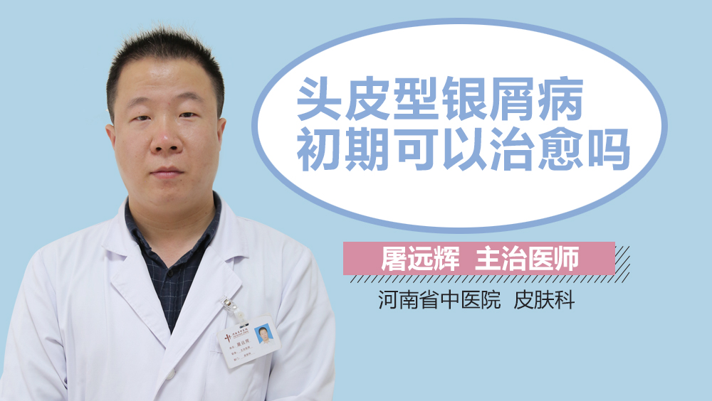 头皮型银屑病初期可以治愈吗