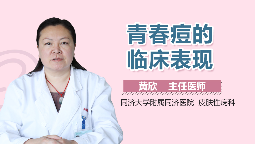 青春痘的临床表现
