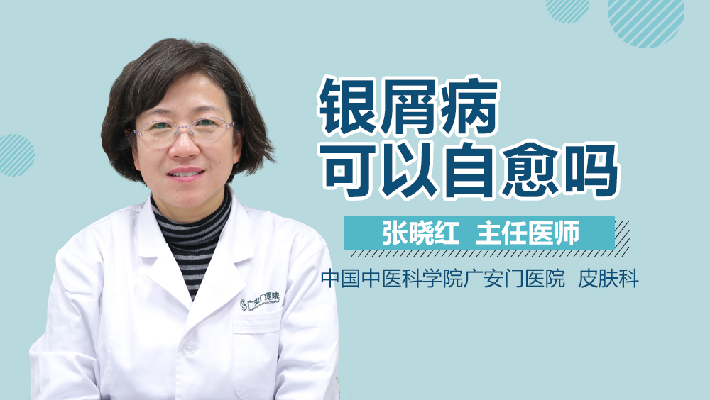 银屑病可以自愈吗