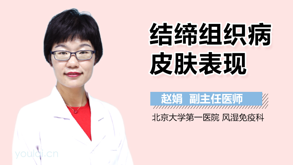 结缔组织病皮肤表现
