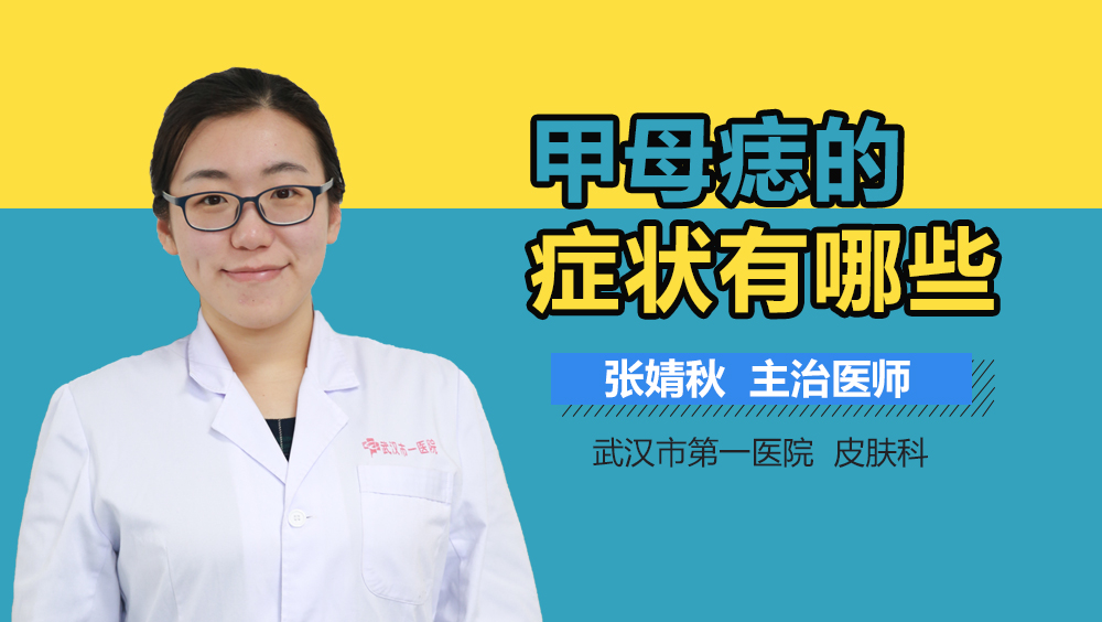 甲母痣的症状有哪些