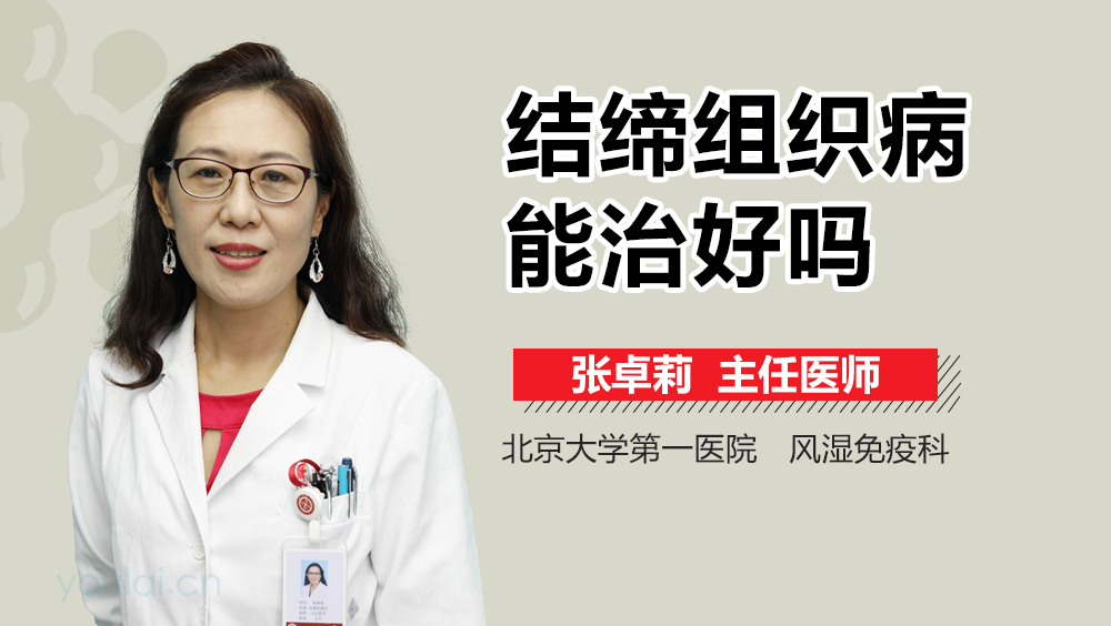结缔组织病能治好吗