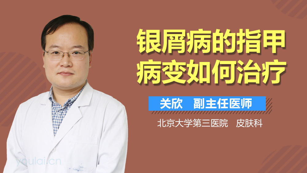 银屑病的指甲病变如何治疗