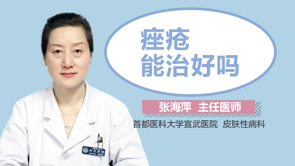 痤疮能治好吗