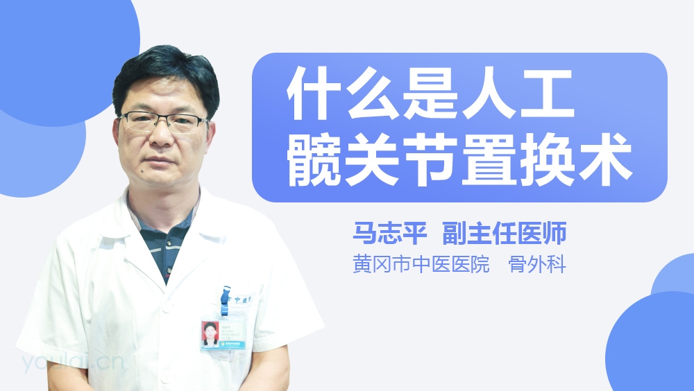 什么是人工髋关节置换术