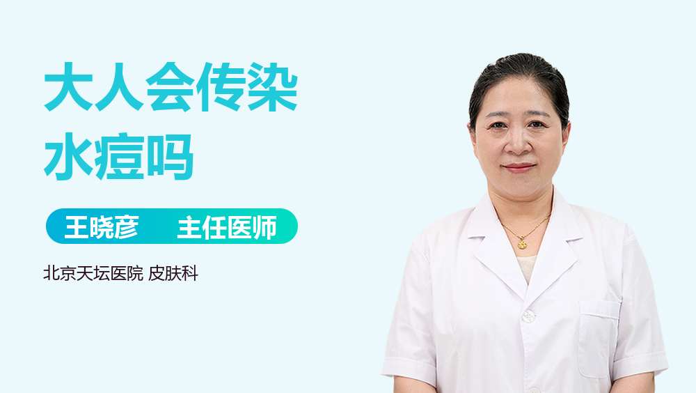 大人会传染水痘吗