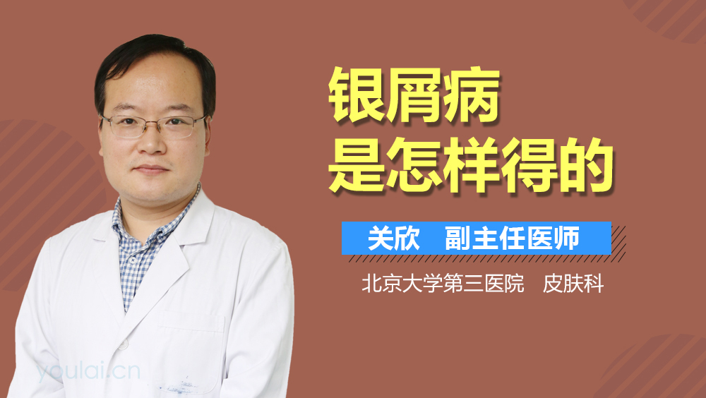 银屑病是怎样得的