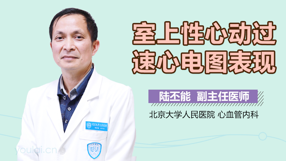 室上性心动过速心电图表现