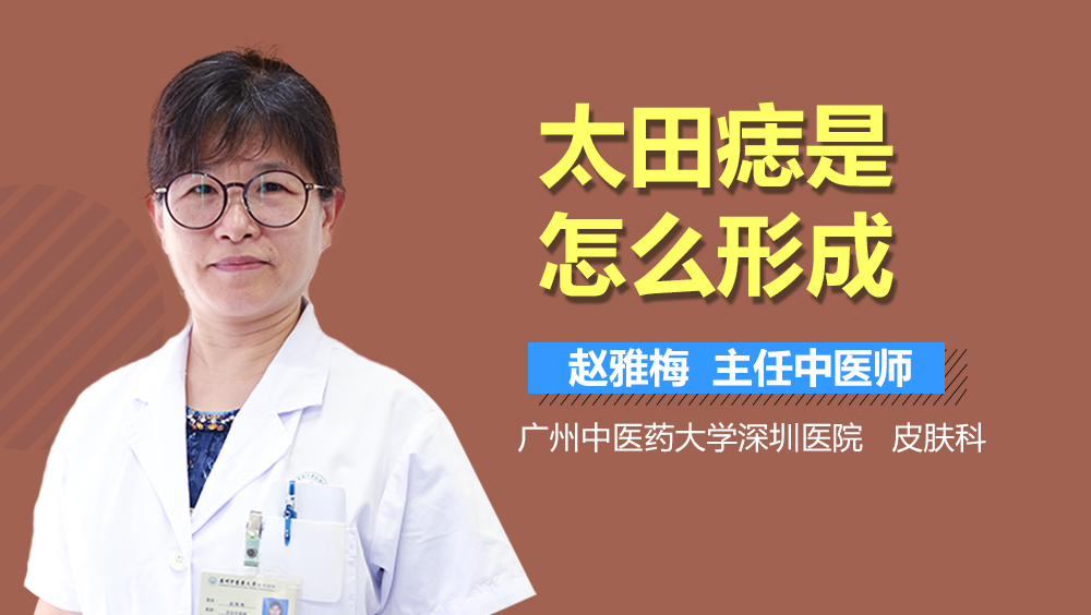 太田痣是怎么形成