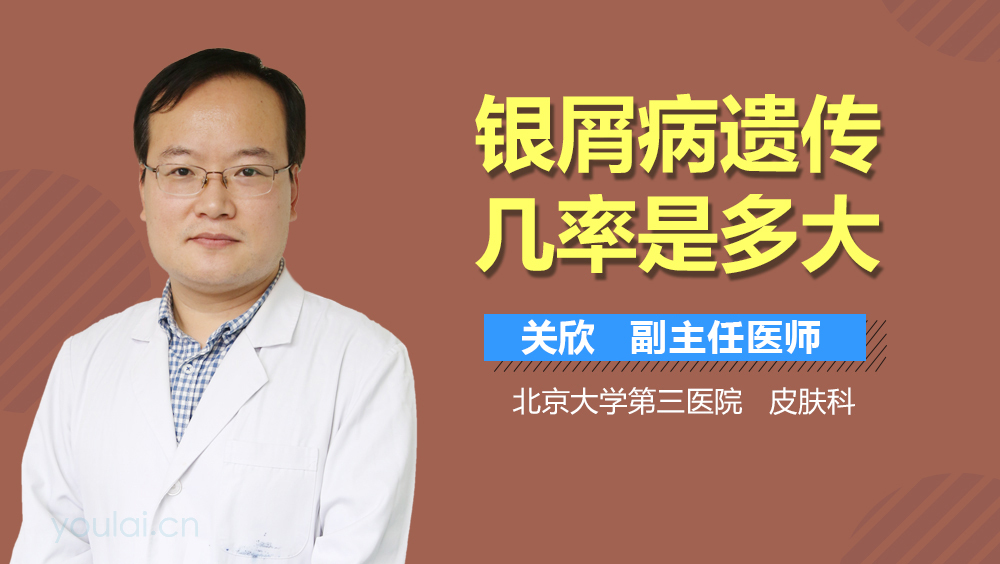 银屑病遗传几率是多大